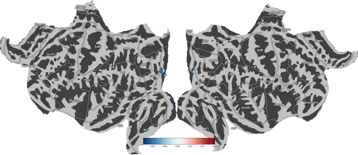 EEG-fMRI Fusion